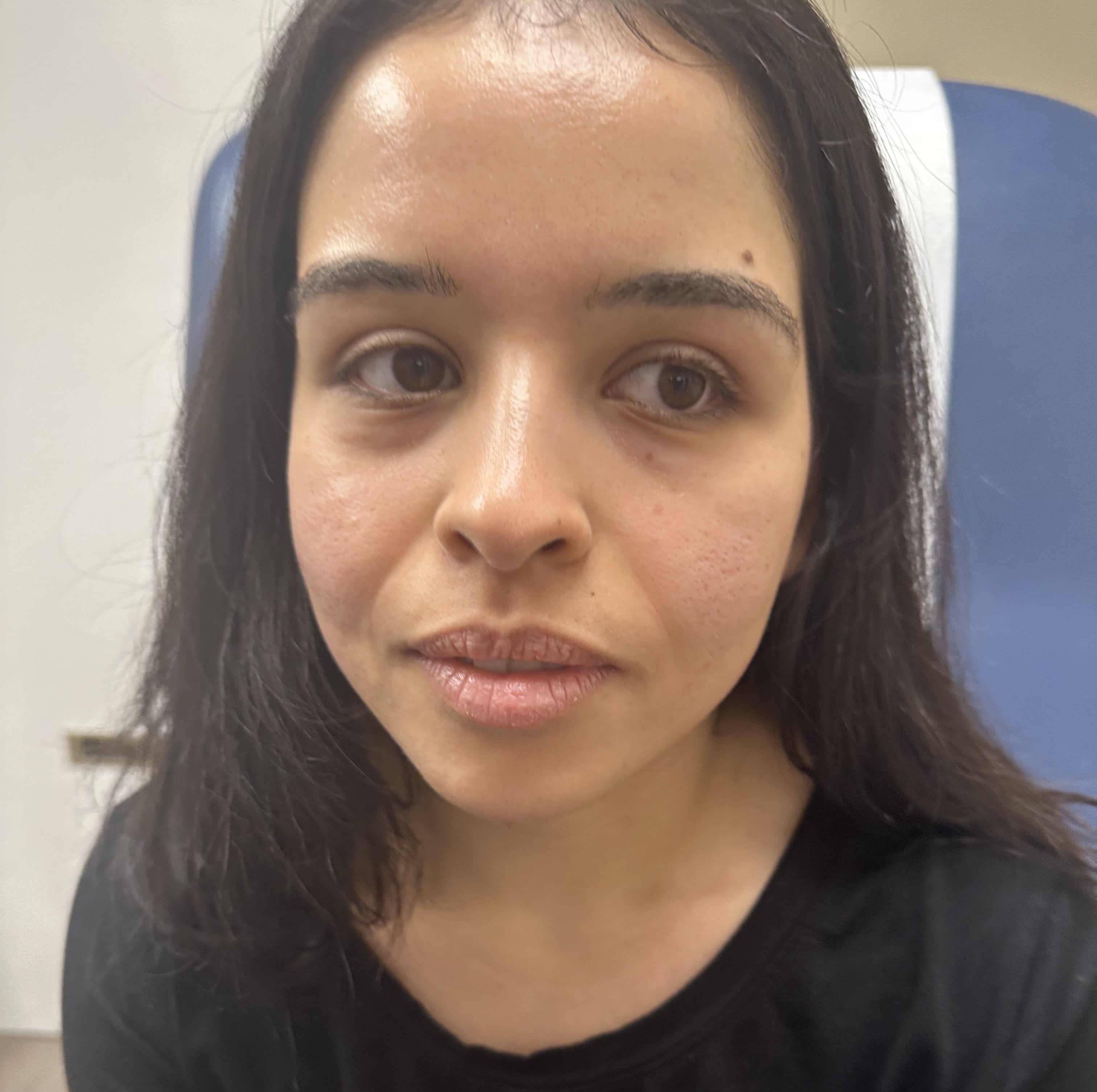 Before and After Picture