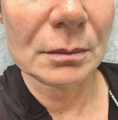 Before and After Picture