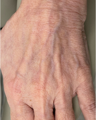 Before and After Picture