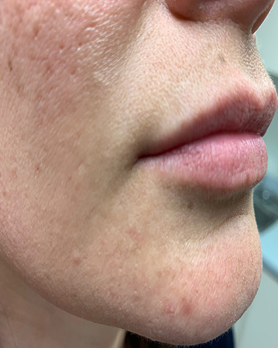 Before and After Picture