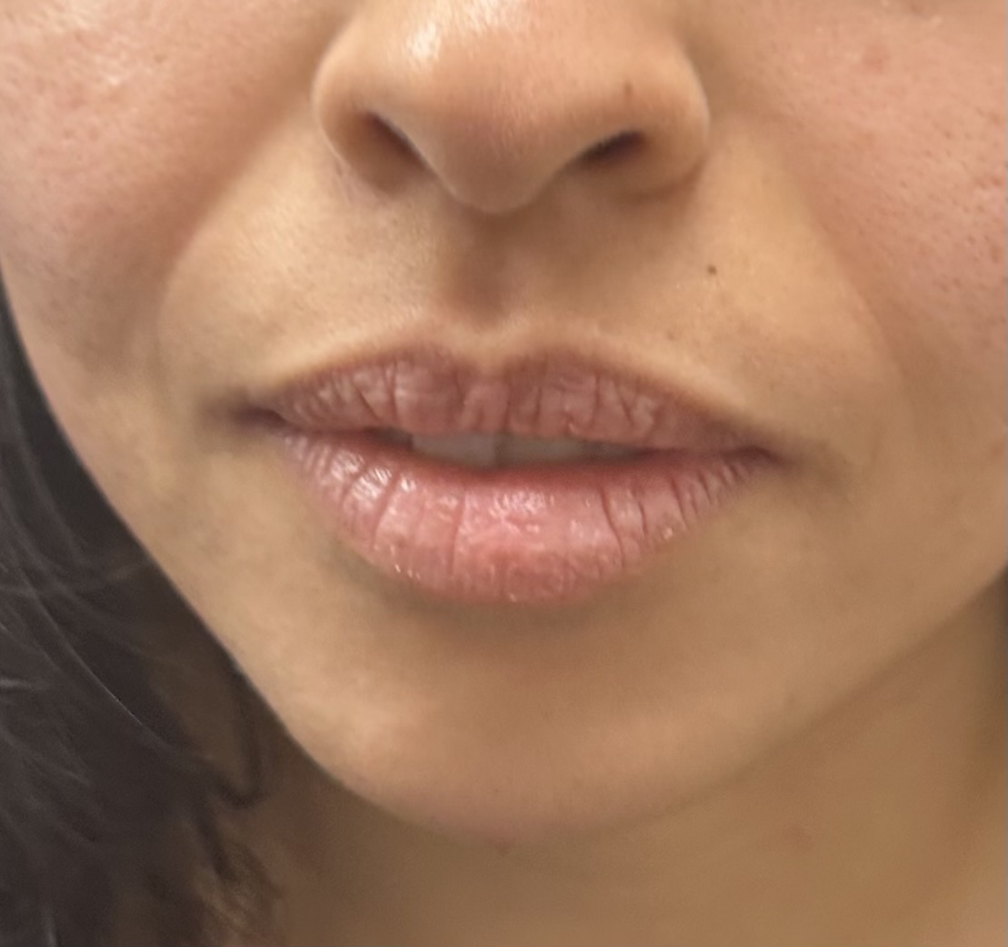 Before and After Picture