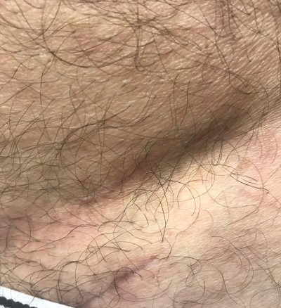 Before and After Picture