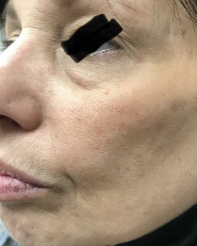 Before and After Picture