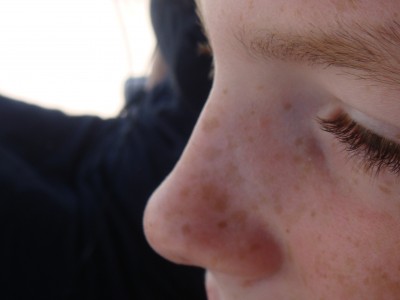 Before and After Picture