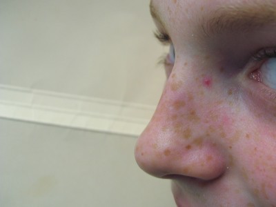 Before and After Picture