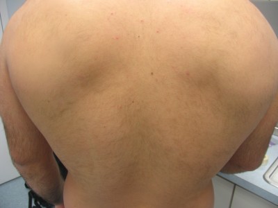 Before and After Picture