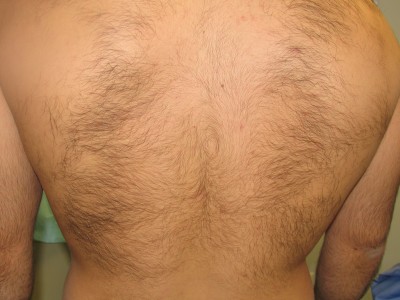 Before and After Picture