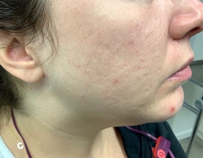 Before and After Picture