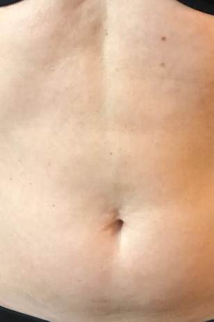 Before and After Picture