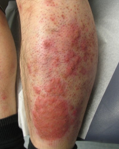 Before and After Picture